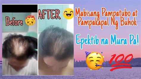 mabisang pampatubo ng buhok sa ulo|MABISANG PAMPATUBO AT PAMPAKAPAL NG .